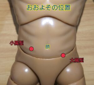人工肛門増設場所のおおよそのイメージ画像