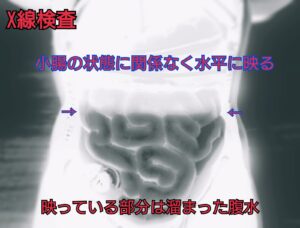 X線検査で見えるニボー/教育用模型を加工したイメージ画像