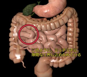 腹腔内の腸管の配置の教育用CG図解