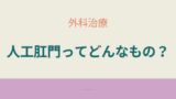 クローン病手術後に造設される人工肛門とは何か。仕組みや役割を初心者向けに解説