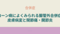 「クローン病の腸管外合併症として多い皮膚病変や関節痛・関節炎の症状と特徴