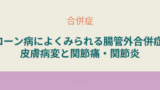 「クローン病の腸管外合併症として多い皮膚病変や関節痛・関節炎の症状と特徴