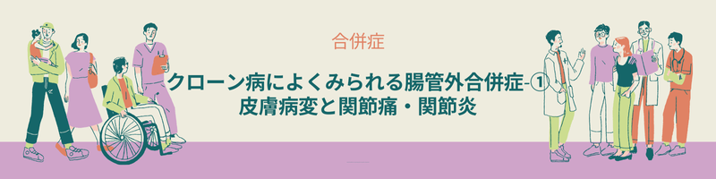 「クローン病の腸管外合併症として多い皮膚病変や関節痛・関節炎の症状と特徴
